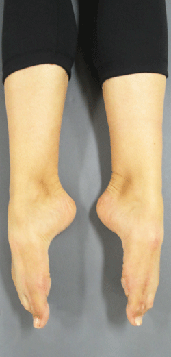 Pilates for Dancers
